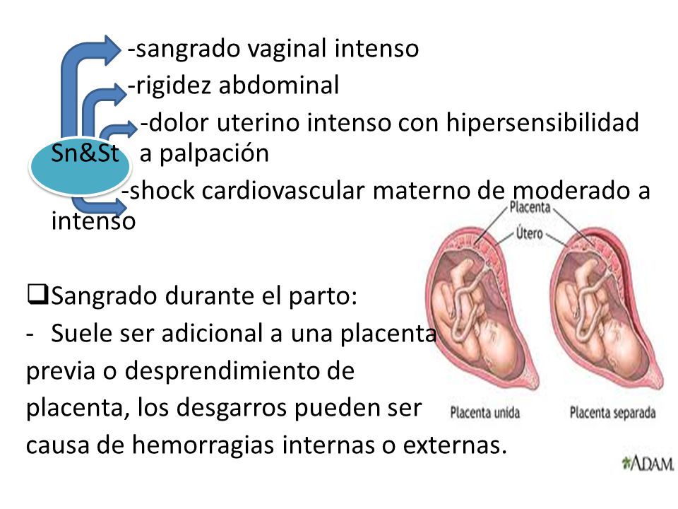 art met open pussy que causa el sangrado vaginal
